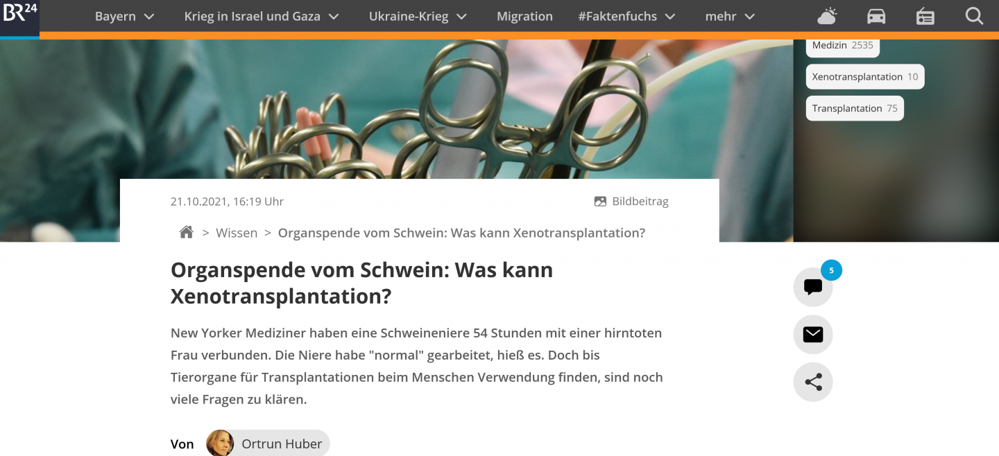 Klicke auf die Grafik für eine vergrößerte Ansicht

Name: grafik.png
Ansichten: 1734
Größe: 619,2 KB
ID: 1409